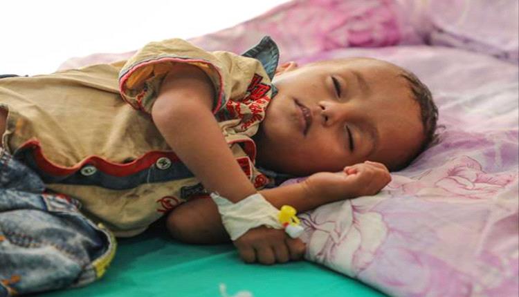 بنحو 5 ملايين دولار.. دعم سعودي جديد لمعالجة سوء التغذية في اليمن
