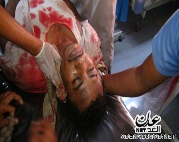 تقرير : عام 2012 الأكثر دموية ومآساوية في عدن