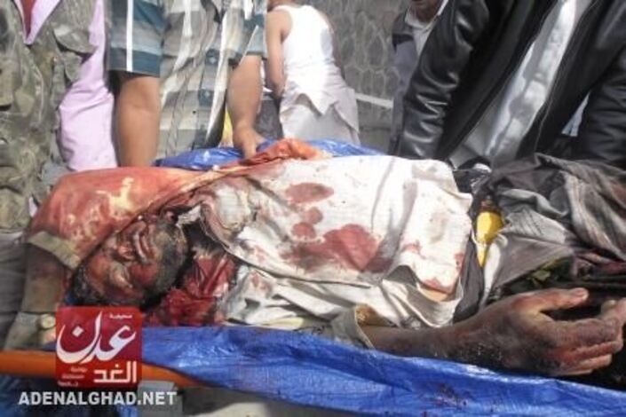 حصيلة :عشرة قتلى وأكثر من 20 جريح في مجزرة ارتكبتها قوات الجيش اليمنية بالضالع (اسماء) -فيديو
