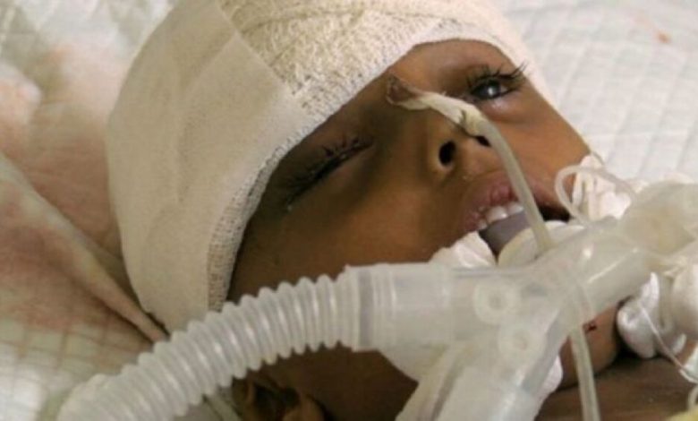الصراع في اليمن: فتاة ومدينة تصارعان من أجل الحياة
