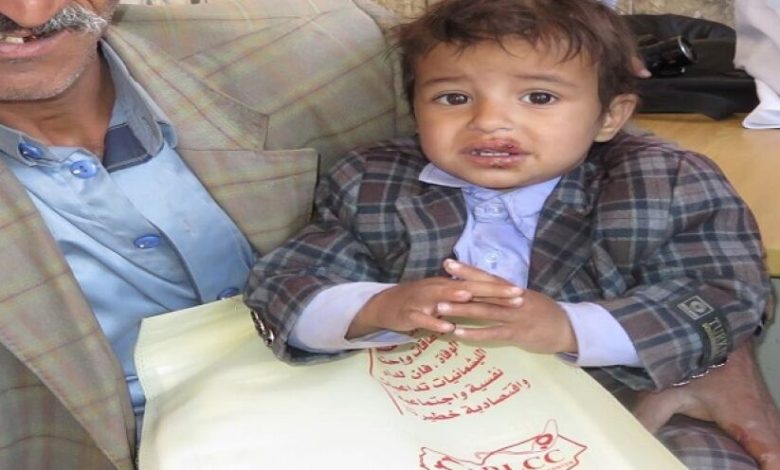 الحرب تخلق داءً فتاكًا يأكل أجساد اليمنيين (صور)