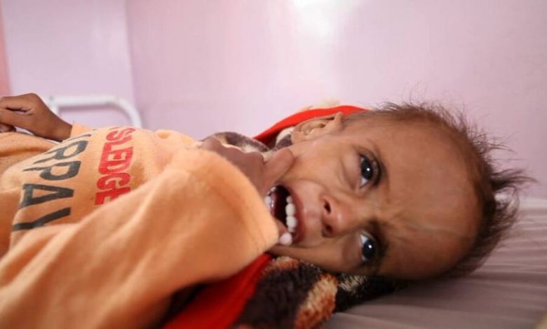 برنامج الأغذية: اليمن يمثل "أكبر حالة طوارئ" لانعدام الأمن الغذائي بالعالم