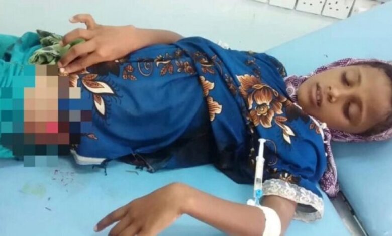 إصابة طفلة بنيران قناصة مليشيات الحوثي في الجبلية بالحديدة