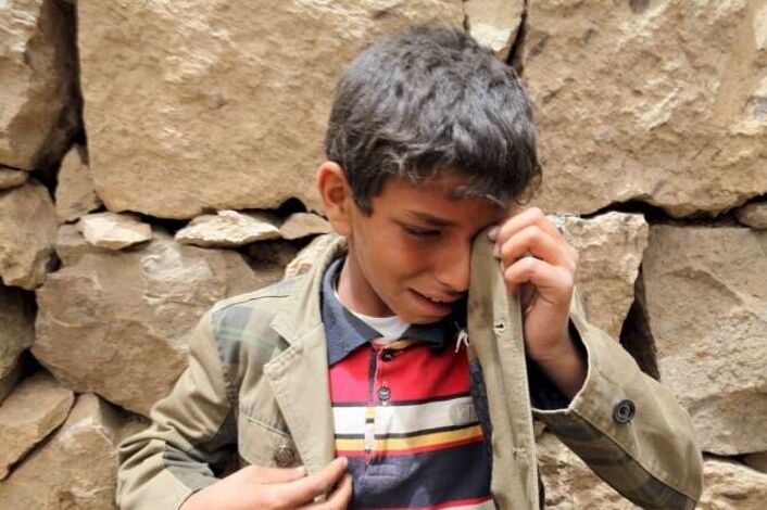 حمران: أطفال اليمن معرضون للإصابة بسلسة من الأمراض